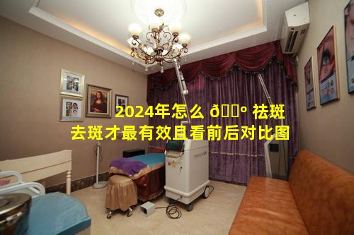 2024年怎么 🌺 祛斑去斑才最有效且看前后对比图